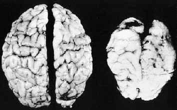 A scan of a brain